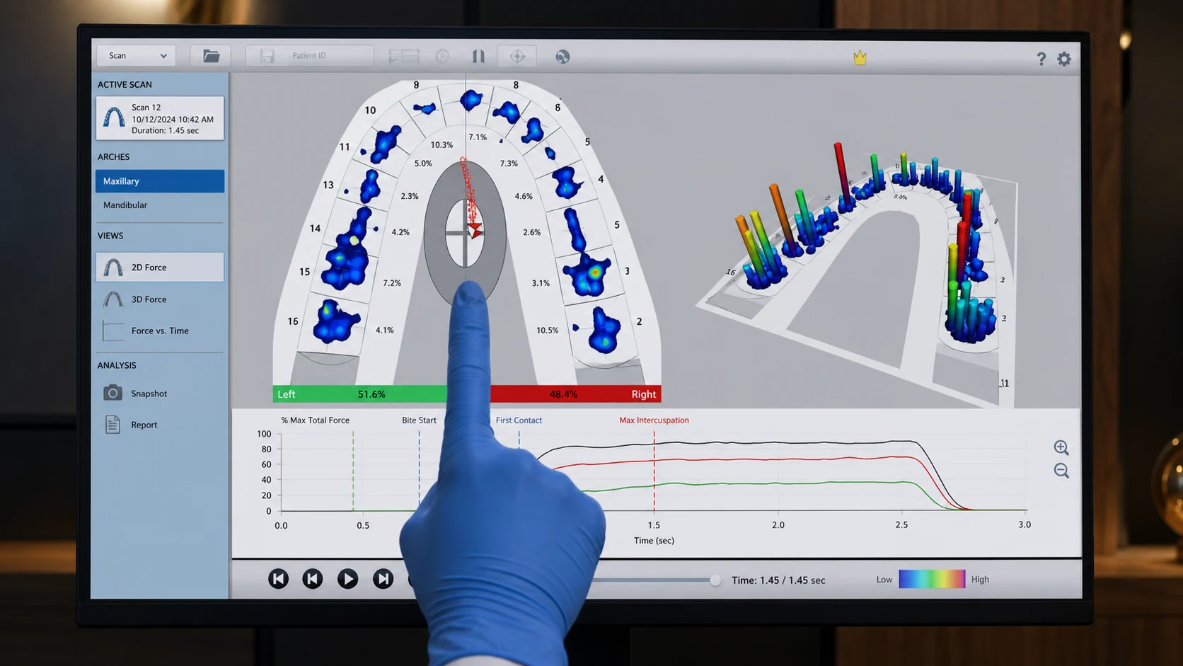 Illustrative T-Scan measurement showing a 2D contact map, 3D relative-force columns, center-of-force path, and force-over-time graph